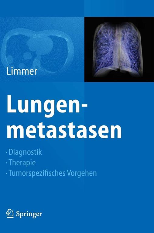 Lungenmetastasen : Diagnostik, Therapie, Tumorspezifisches Vorgehen