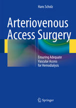 Arteriovenous Access Surgery Ensuring Adequate Vascular Access for Hemodialysis