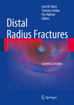 Distal Radius Fractures Current Concepts