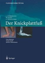 FussdeformitÄten : Der Knickplattfuss