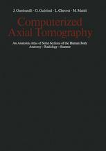 Camputerized Axial Tomography : an Anatomic Atlas of Serial Sections of the Human Body Anatomy - Radiology - Scanner