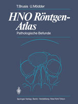 HNO Röntgen-Atlas : Pathologische Befunde