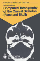 Computed Tomography of the Cranial Skeleton (Face and Skull) : 58 Radiological Exercises for Students and Practitioners