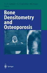 Bone densitometry and osteoporosis