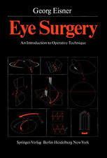 Eye Surgery An Introduction to Operative Technique