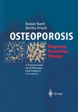 Osteoporosis : diagnosis, prevention, therapy : a practical guide for all physicians--from pediatrics to geriatrics