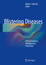 Blistering Diseases Clinical Features, Pathogenesis, Treatment