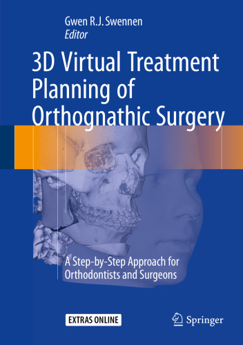 3D Virtual Treatment Planning of Orthognathic Surgery A Step-by-Step Approach for Orthodontists and Surgeons.