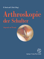 Arthroskopie der Schulter Diagnostik und Therapie