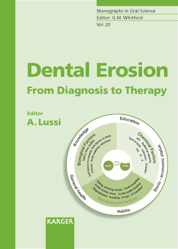 Dental Erosion: From Diagnosis to Therapy (Monographs in Oral Science, Vol. 20)