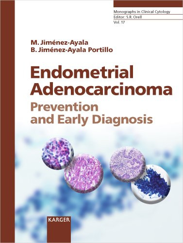 Endometrial Adenocarcinoma: Prevention and Early Diagnosis Including contributions by Iglesias Goy, E. (Madrid); Rios Vallejo, M. (Madrid)