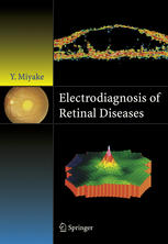 Electrodiagnosis of retinal disease