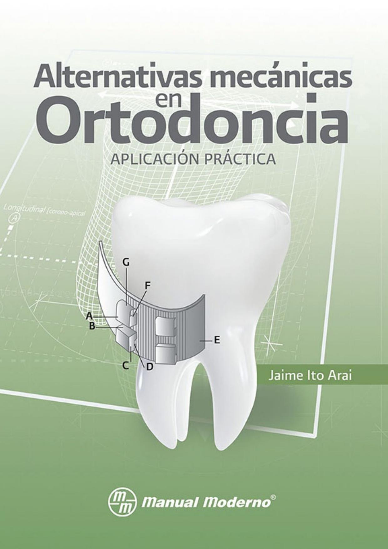 Alternativas mecánicas en ortodoncia : aplicación práctica