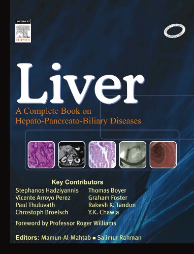 Liver : a complete book on hepato-pancreato-biliary diseases