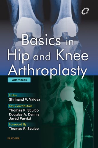 Basics in Hip and Knee Arthroplasty - E-Book