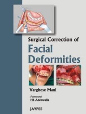 Surgical Correction of Facial Deformities