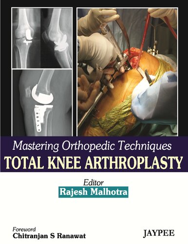 Mastering Orthopedic Techniques Total Knee Arthroplasty