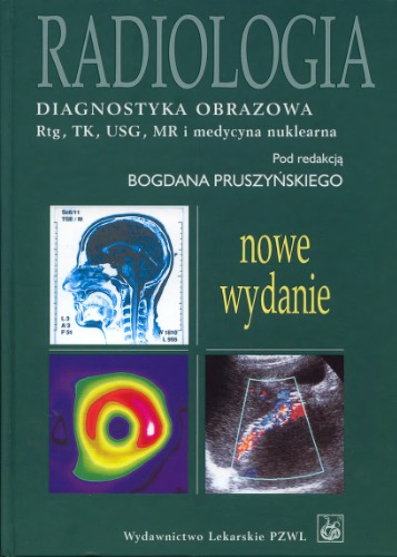 Radiologia : diagnostyka obrazowa - Rtg, TK, USG, MR i radioizotopy