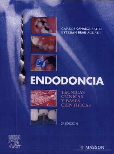 Endodoncia : técnicas clínicas y bases científicas