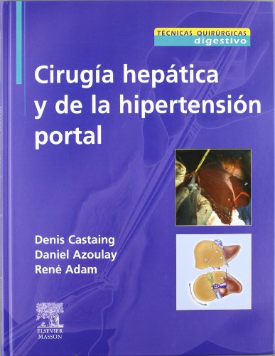 Cirugía hepática y de la hipertensión portal