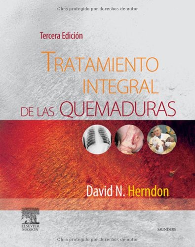 Tratamiento Integral de Las Quemaduras