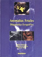 Anomalías fetales : diagnóstico ecográfico