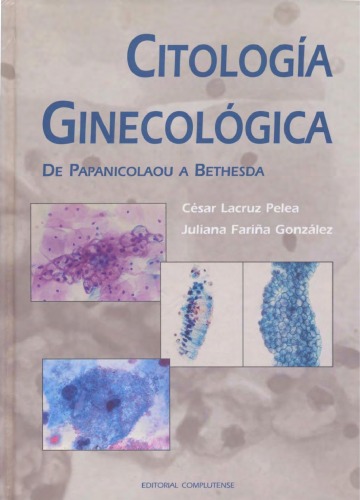 Citologia Ginecologica/ Gynecologic Cytology