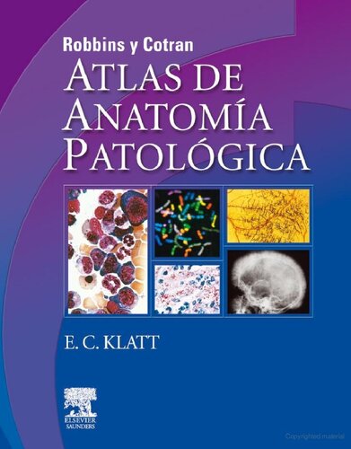 Robbins y Cotran : atlas de anatomía patológica