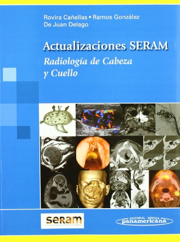 Radiología de cabeza y cuello : Actualizaciones SERAM.