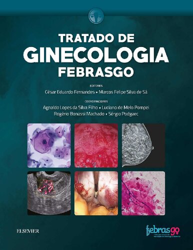 Tratado de Ginecologia