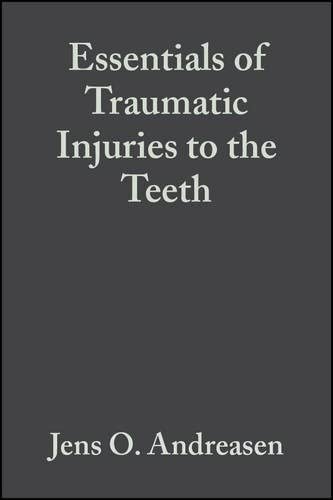 Essentials of Traumatic Injuries to the Teeth: A Step-by-Step Treatment Guide