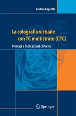 La colografia virtuale con TC multistrato (CTC)