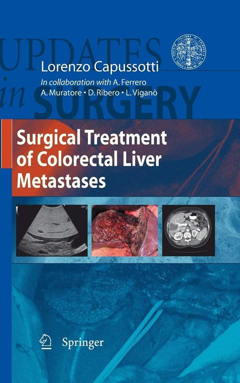 Surgical Treatment Of Colorectal Liver Metastases (Updates In Surgery)