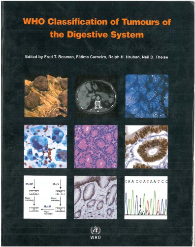 WHO Classification of Tumours of the Digestive System