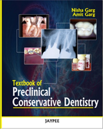 Textbook Of Preclinical Conservative Dentistry.