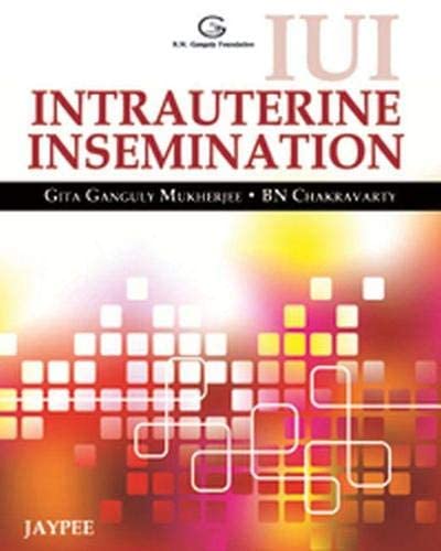 IUI Intrauterine Insemination