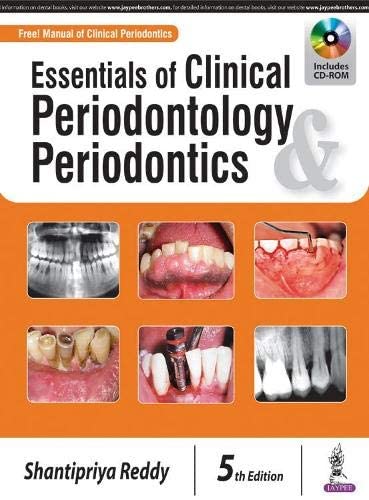 Essentials of Clinical Periodontology &amp; Periodontics