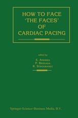 How to Face 'the Faces' of CARDIAC PACING.