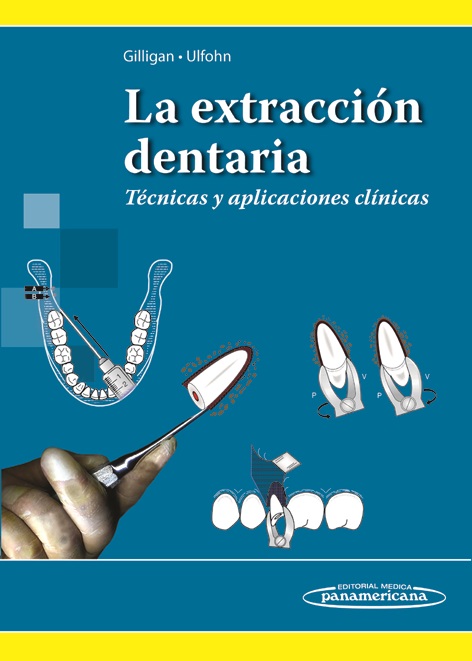 La extracción dentaria : técnicas y aplicaciones clínicas