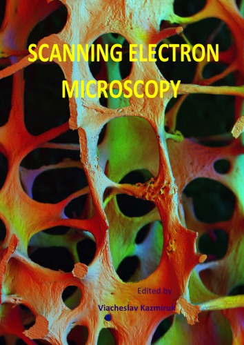 SEM Analysis of Precipitation Process in Alloys.