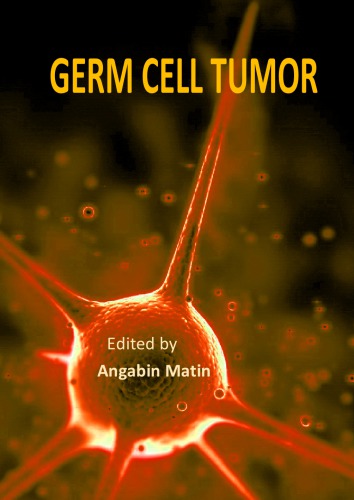 Intratubular Germ Cell Neoplasms of the Testis and Bilateral Testicular Tumors: Clinical Significance and Management Options.