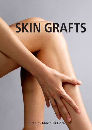 Skin grafts