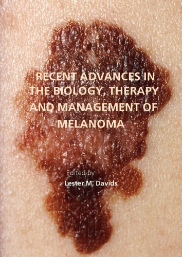 Recent advances in the biology, therapy and management of melanoma