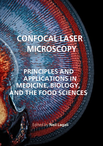 Confocal laser microscopy : principles and applications in medicine, biology, and the food sciences