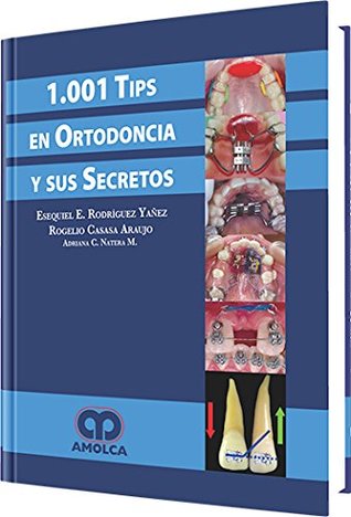 1001 Tips en Ortodoncia y sus secretos