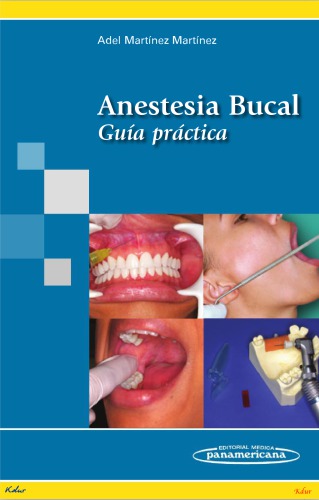 Anestesia bucal : guía práctica