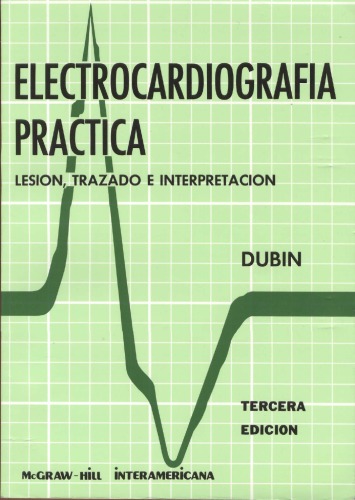 Electrocardiografia Practica