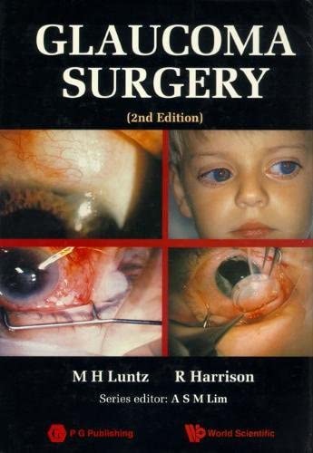 Glaucoma Surgery (2nd Edition) (World Scientific Series in Contemporary Chemical Physics)