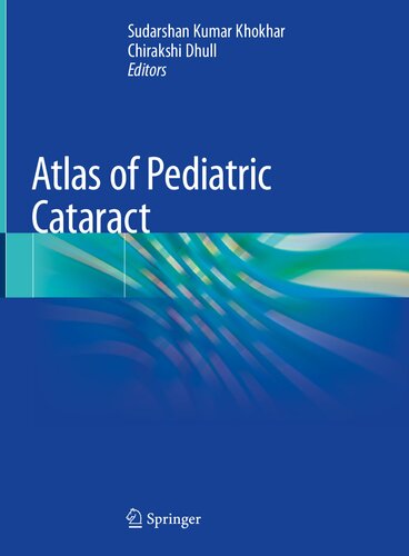 Atlas of Pediatric Cataract