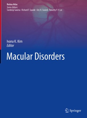Macular disorders